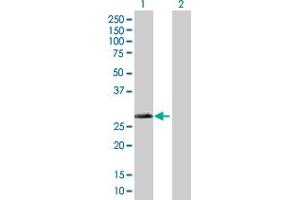 Image no. 1 for anti-Dehydrogenase/reductase (SDR Family) Member 4 (DHRS4) (AA 1-278) antibody (ABIN524308)