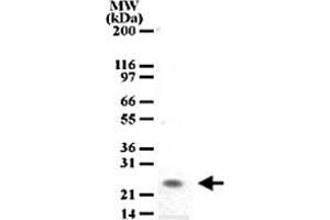 Image no. 1 for anti-Peptidoglycan Recognition Protein 1 (PGLYRP1) antibody (ABIN531970)
