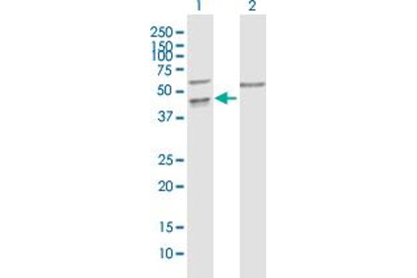 anti-Leucine Rich Repeat Protein 1 (LRR1) (AA 1-414) antibody