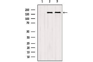 Image no. 2 for anti-CCR4-NOT Transcription Complex, Subunit 1 (CNOT1) (Internal Region) antibody (ABIN6260912)