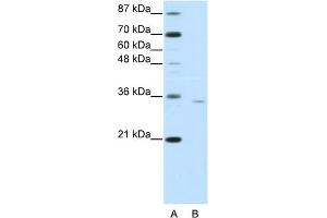 Image no. 1 for anti-Orthopedia Homeobox (OTP) (C-Term) antibody (ABIN2778383)