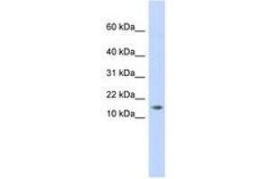 Image no. 1 for anti-Adipogenesis Associated Mth938 Domain Containing (AAMDC) (C-Term) antibody (ABIN6741319)