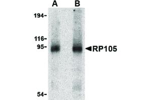 Image no. 1 for anti-CD180 Molecule (CD180) (Internal Region) antibody (ABIN6655934)
