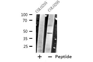 Image no. 1 for anti-Corticotropin Releasing Hormone Receptor 2 (CRHR2) antibody (ABIN6257813)