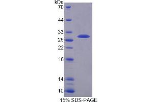 Image no. 1 for Transmembrane Protease, serine 2 (TMPRSS2) (AA 254-490) protein (His tag) (ABIN6237811)