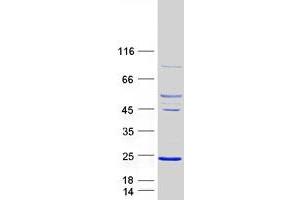 Image no. 1 for ADP-Ribosylation Factor-Like 5A (ARL5A) (Transcript Variant 1) protein (Myc-DYKDDDDK Tag) (ABIN2714913)