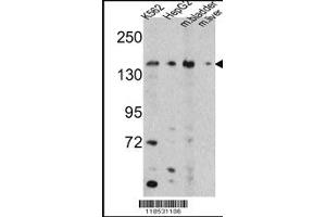 Image no. 2 for anti-5-Oxoprolinase (ATP-Hydrolysing) (OPLAH) antibody (ABIN2448454)