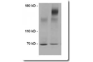 Image no. 1 for Transmembrane Protein Extraction Reagent (ABIN1059100)