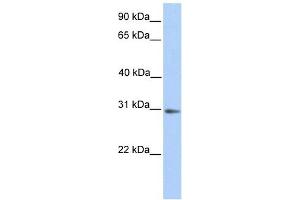 Image no. 1 for anti-Ubiquitously Transcribed Tetratricopeptide Repeat Gene, Y-Linked (UTY) (Middle Region) antibody (ABIN635523)