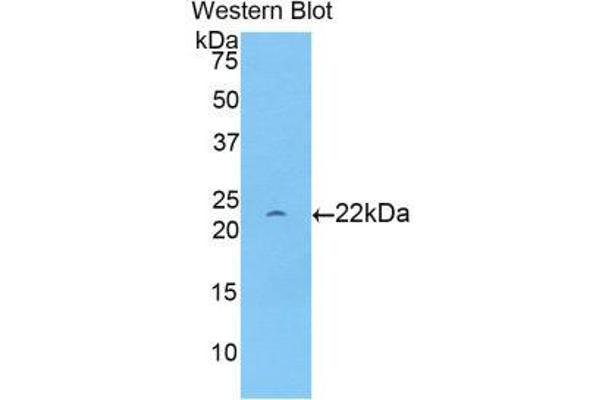 anti-Apolipoprotein D (APOD) (AA 21-189) antibody