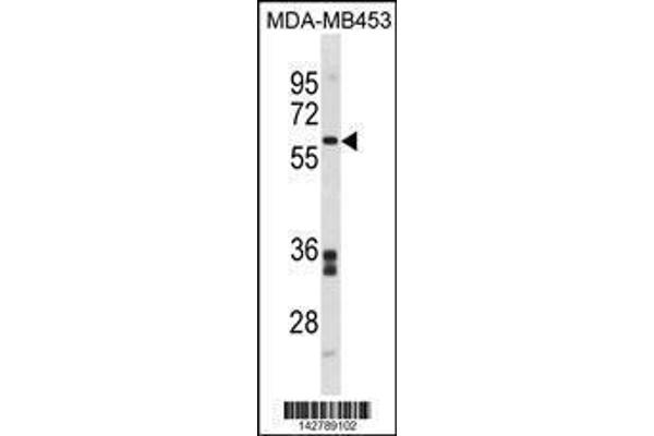 anti-Flavin Containing Monooxygenase 5 (FMO5) (AA 474-502), (C-Term) antibody