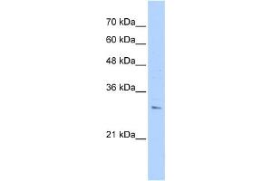 Image no. 1 for anti-Rhomboid, Veinlet-Like 2 (RHBDL2) (N-Term) antibody (ABIN2782919)