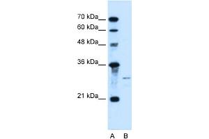Image no. 1 for anti-Sonic Hedgehog (SHH) (N-Term) antibody (ABIN2781775)