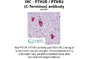 Image no. 1 for anti-Parathyroid Hormone 2 Receptor (PTH2R) (C-Term), (pThr2) antibody (ABIN1738583)