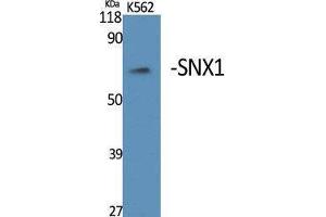 Image no. 1 for anti-Sorting Nexin 1 (SNX1) (Internal Region) antibody (ABIN3187014)