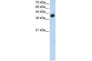 Image no. 1 for anti-Microtubule Associated Tumor Suppressor 1 (MTUS1) (N-Term) antibody (ABIN2781854)