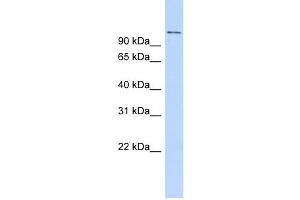 Image no. 3 for anti-Retinoblastoma Binding Protein 8 (RBBP8) (C-Term) antibody (ABIN2784374)