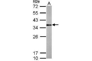 Image no. 4 for anti-Thiosulfate Sulfurtransferase (Rhodanese) (TST) (Center) antibody (ABIN2856290)