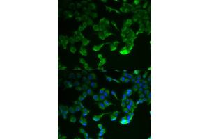 Image no. 3 for anti-Complement Component 1, R Subcomponent (C1R) antibody (ABIN2561500)