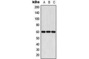 Western blot analysis of Cytochrome P450 11A1 expression in Jurkat (A), mouse liver (B), rat liver (C) whole cell lysates.