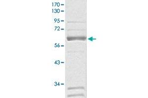 Image no. 1 for V-Raf-1 Murine Leukemia Viral Oncogene Homolog 1 (RAF1) protein (GST tag) (ABIN5570242)