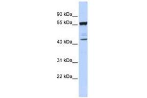 Image no. 1 for anti-Sex Comb On Midleg-Like 4 (SCML4) (AA 72-121) antibody (ABIN6740386)