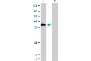 Image no. 2 for anti-Homeobox A11 (HOXA11) (AA 60-166) antibody (ABIN561319)