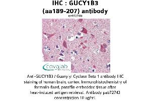 Image no. 2 for anti-Guanylate Cyclase 1, Soluble, beta 3 (GUCY1B3) (AA 189-207) antibody (ABIN2852385)