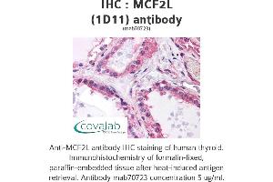 Image no. 1 for anti-MCF.2 Cell Line Derived Transforming Sequence-Like (MCF2L) (AA 220-320) antibody (ABIN1723580)