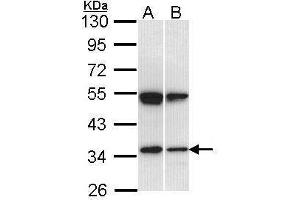 Image no. 2 for anti-SH3-Domain GRB2-Like 1 (SH3GL1) (Center) antibody (ABIN2856917)