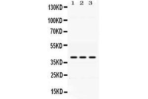 Image no. 1 for anti-Alcohol Dehydrogenase 1A (Class I), alpha Polypeptide (ADH1A) (AA 213-375) antibody (ABIN4886427)