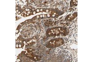 Image no. 1 for anti-Testis Development Related Protein (TDRP) antibody (ABIN5573476)