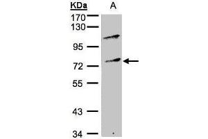 WB Image Sample(30 ug whole cell lysate) A:Raji , 10% SDS PAGE antibody diluted at 1:500