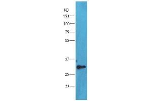 Image no. 3 for anti-Thioredoxin Domain Containing 9 (TXNDC9) (AA 182-226) antibody (ABIN1387753)