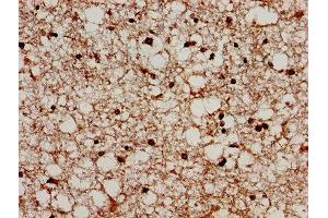IHC image of ABIN7164750 diluted at 1:300 and staining in paraffin-embedded human brain tissue performed on a Leica BondTM system.