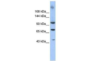 Image no. 1 for anti-Terminal Uridylyl Transferase 1, U6 SnRNA-Specific (TUT1) (N-Term) antibody (ABIN927437)