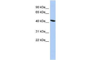 WB Suggested Anti-ZNF71 Antibody Titration: 1 ug/ml Positive Control: PANC1 cell lysate