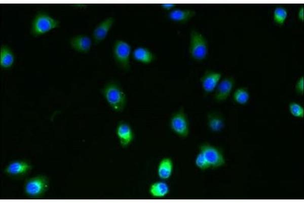 SLC35B4 anticorps  (AA 174-200)