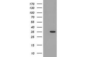 Image no. 2 for anti-Sulfotransferase Family, Cytosolic, 1A, Phenol-Preferring, Member 1 (SULT1A1) antibody (ABIN1501226)