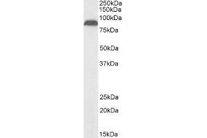 Image no. 1 for anti-Transient Receptor Potential Cation Channel, Subfamily V, Member 5 (TRPV5) (Internal Region) antibody (Biotin) (ABIN5539600)
