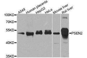 Image no. 3 for anti-Presenilin 2 (Alzheimer Disease 4) (PSEN2) antibody (ABIN6146291)