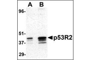 Image no. 1 for anti-Ribonucleotide Reductase M2 B (TP53 Inducible) (RRM2B) (AA 2-17), (N-Term) antibody (ABIN500437)