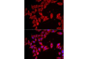 Image no. 1 for anti-Solute Carrier Family 35 (UDP-Galactose Transporter), Member A2 (SLC35A2) antibody (ABIN2559972)