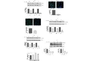 Immunofluorescence (IF) image for anti-Collagen, Type I (COL1) antibody (ABIN5596819)