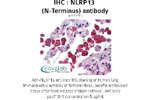 Image no. 1 for anti-NLR Family, Pyrin Domain Containing 13 (NLRP13) (N-Term) antibody (ABIN1737388)