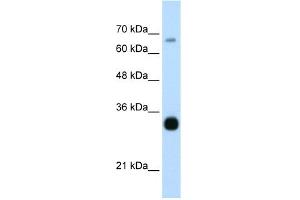 Image no. 1 for anti-THO Complex 3 (THOC3) (Middle Region) antibody (ABIN2776596)