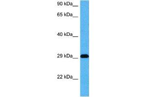 Image no. 2 for anti-Caudal Type Homeobox 2 (CDX2) (Middle Region) antibody (ABIN2777319)