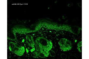 Image no. 3 for anti-Superoxide Dismutase 2, Mitochondrial (SOD2) antibody (FITC) (ABIN2484765)
