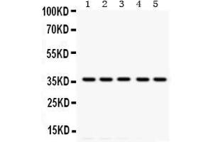 Image no. 1 for anti-Tropomyosin 1 (Alpha) (TPM1) antibody (ABIN3043113)