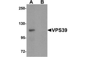 Image no. 1 for anti-Vacuolar Protein Sorting 39 Homolog (VPS39) (C-Term) antibody (ABIN783395)